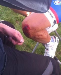 bouhanni-knee